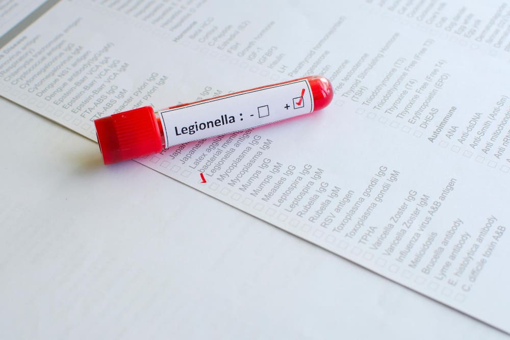 apa itu legionella